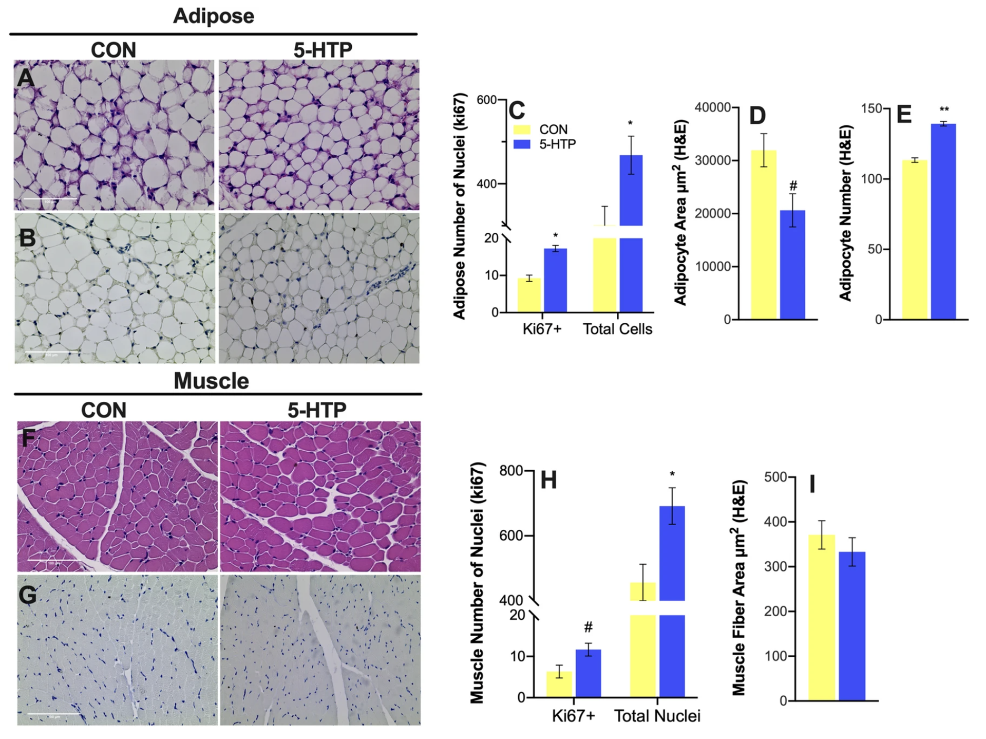 Histological and transcriptomic analysis of adipose and muscle of dairy calves supplemented with 5-hydroxytryptophan